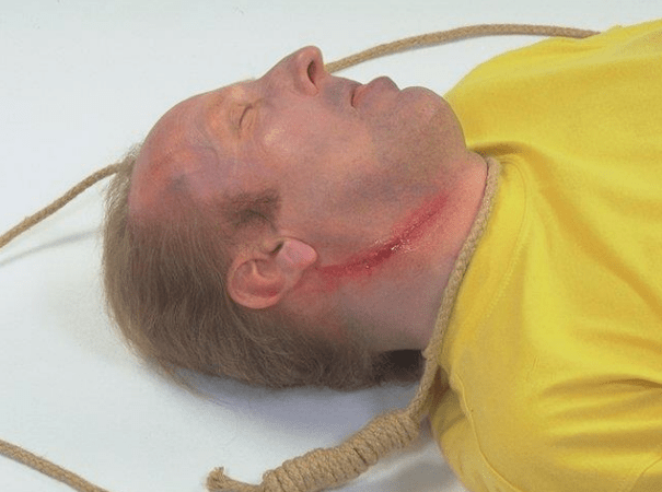 asılma, boğulma, suicid