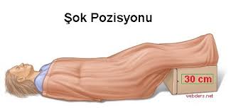 şok pozisyonu